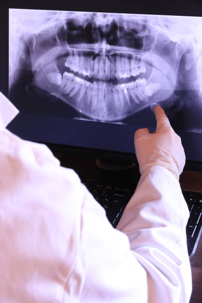 Best Broken or Chipped Tooth Repair in Carlisle, IA